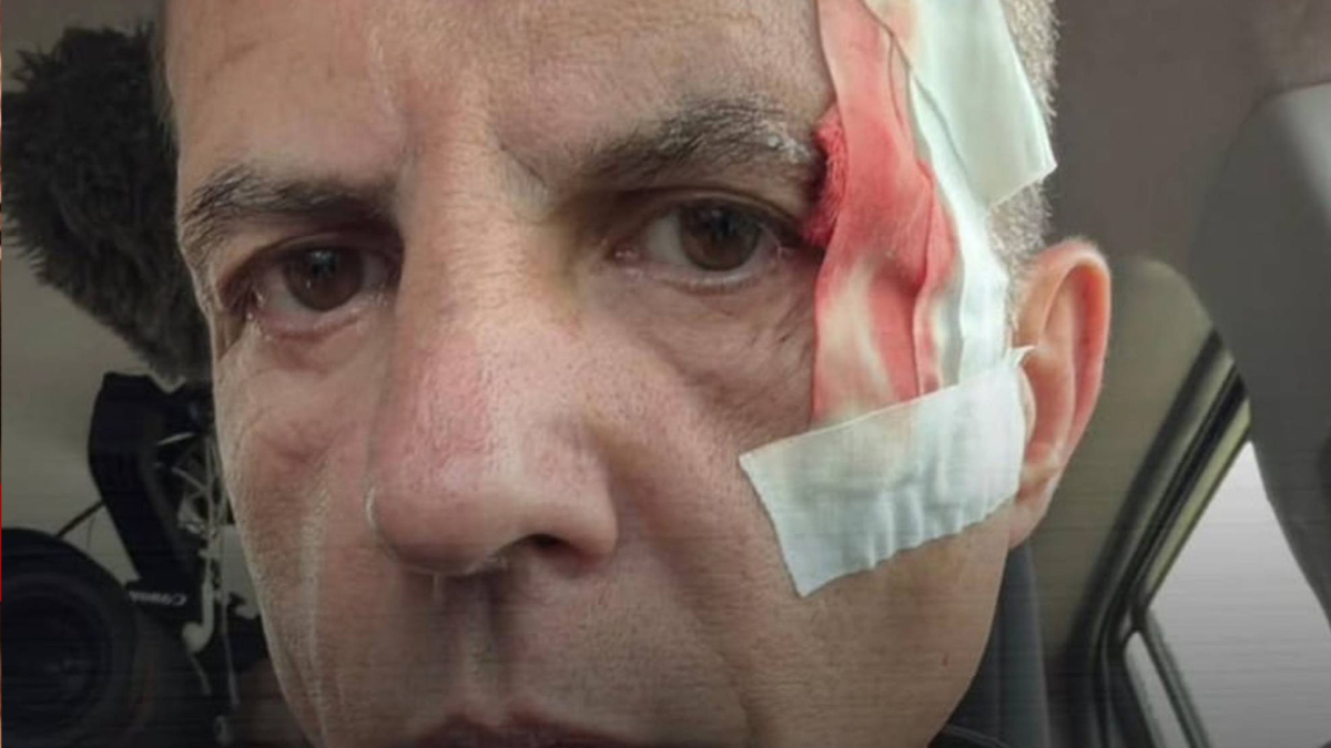 Jesús Calleja explica el accidente de Cristóbal Soria haciendo rafting: “Necesitó cinco puntos”